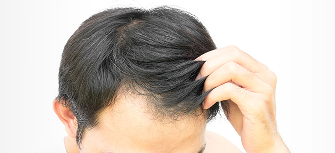 Hair Transplant Surgery | Cincinnati, OH